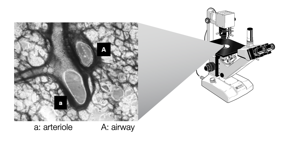 lung microscope