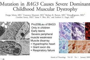 The Role Of BAG3 In Dilated Cardiomyopathy