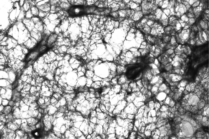 precision-cut lung slice (PCLS) under microscope