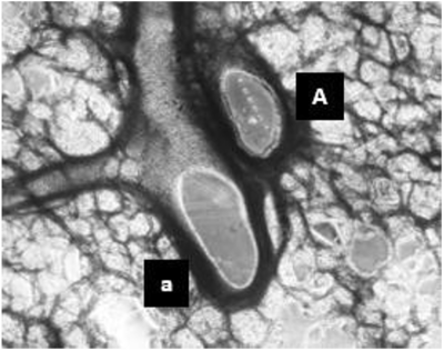 Brightfield image of a thawed PCLS with arteriole and airway labeled.