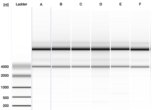 Northern blot of precision-cut lung slices from 6 different donors.